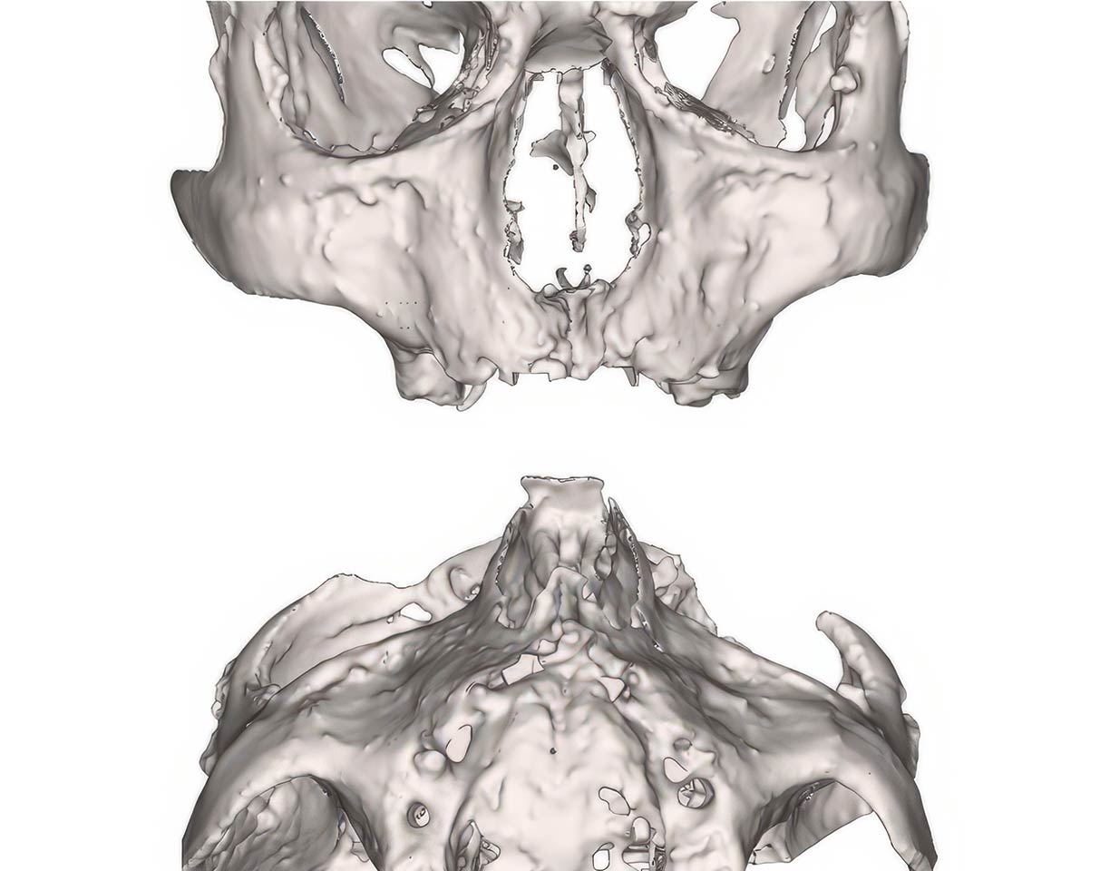 Escaneo de un cráneo