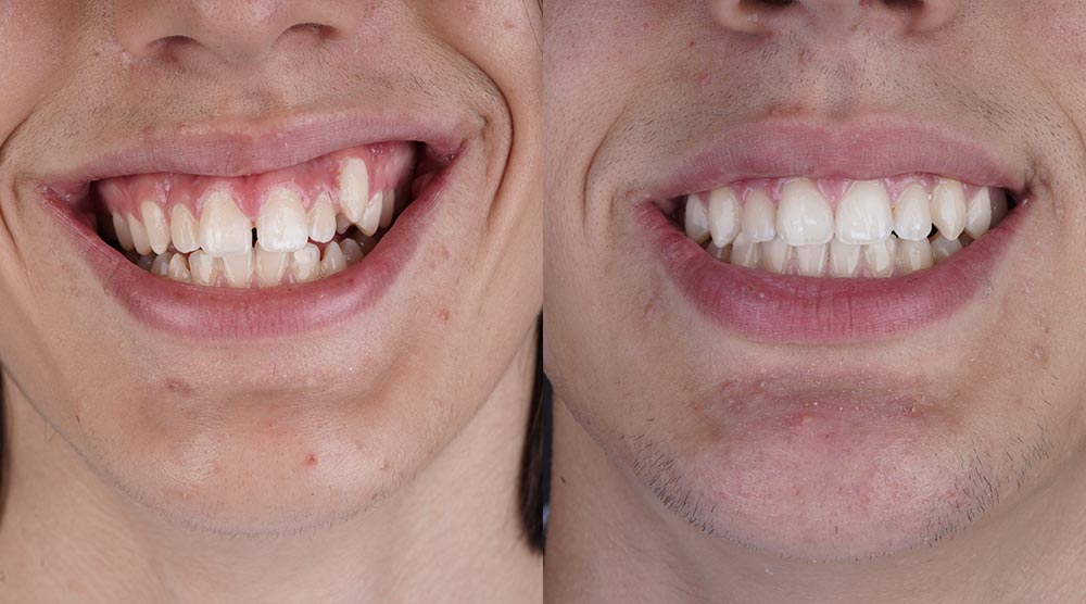 caso clínico de ortodoncia